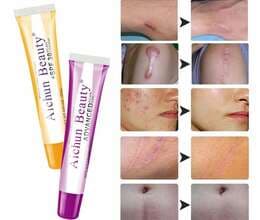 Çapıqlar üçün krem