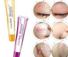 Çapığ üçün krem